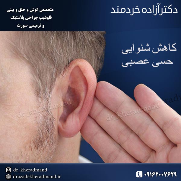 کاهش شنوایی حسی عصبی