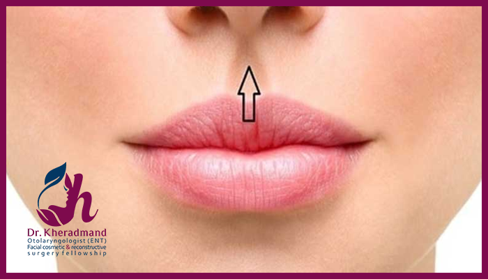 نحوه کاهش عوارض لیفت سانترال لب
